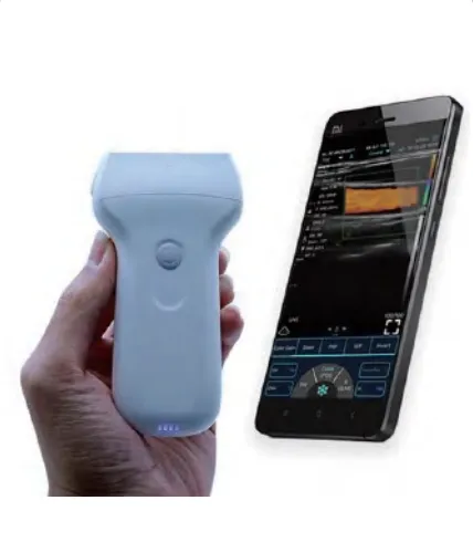 Портативный ультразвуковой сканер USB и WiFi AKCSB-C10UL