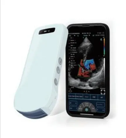 Цветной допплеровский беспроводной и USB-датчик «три в одном» для ультразвуковой диагностики AKCSB-C10T