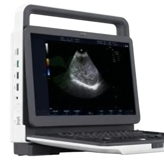 Портативный 3D/4D ультразвуковой аппарат цветного допплера AKCSB-M30