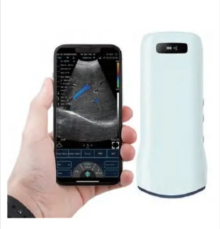 HD Color Doppler Wireless & USB Convex Pro...