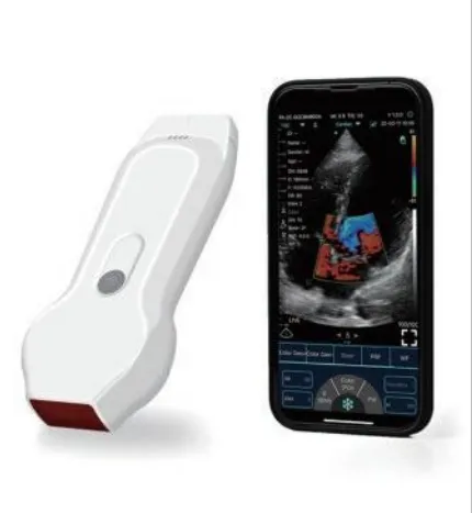 15 наиболее экономичных портативных ультразвуковых аппаратов: по областям применения (издание 2025 года)