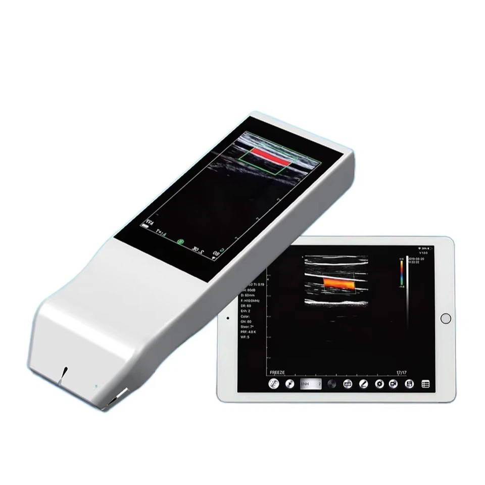 Беспроводной портативный ультразвуковой аппарат AKCSB-V5L