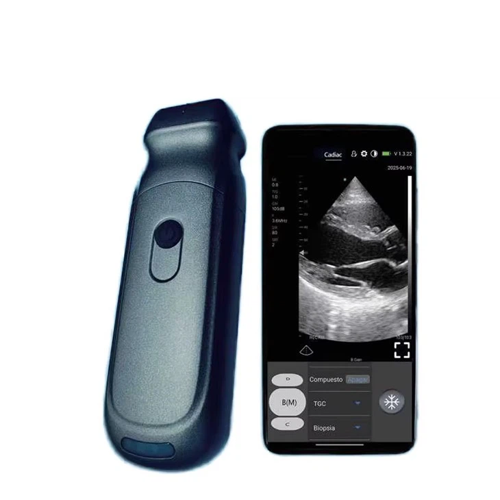 Беспроводной портативный ультразвуковой сканер с двумя головками AKCSB-S9PA