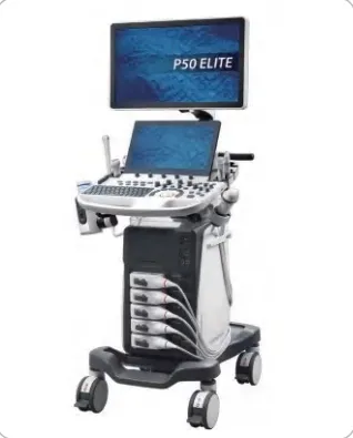 Мобильная цветная допплеровская ультразвуковая система Sonoscape P50 Elite