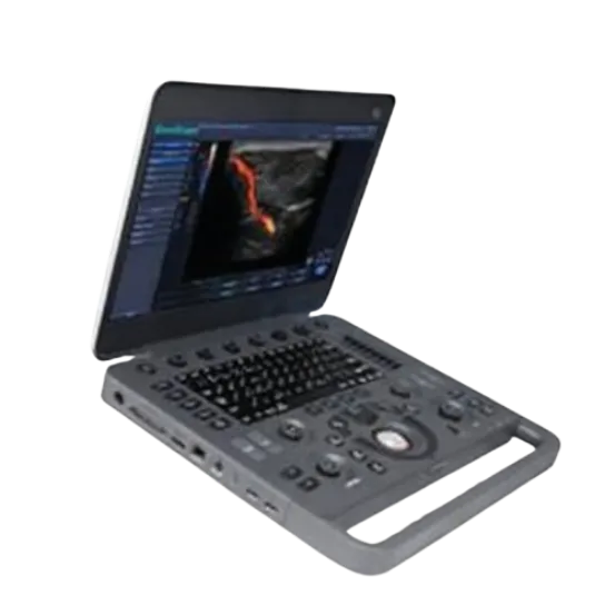 Портативный цветной допплеровский ультразвуковой сканер SonoScape X3