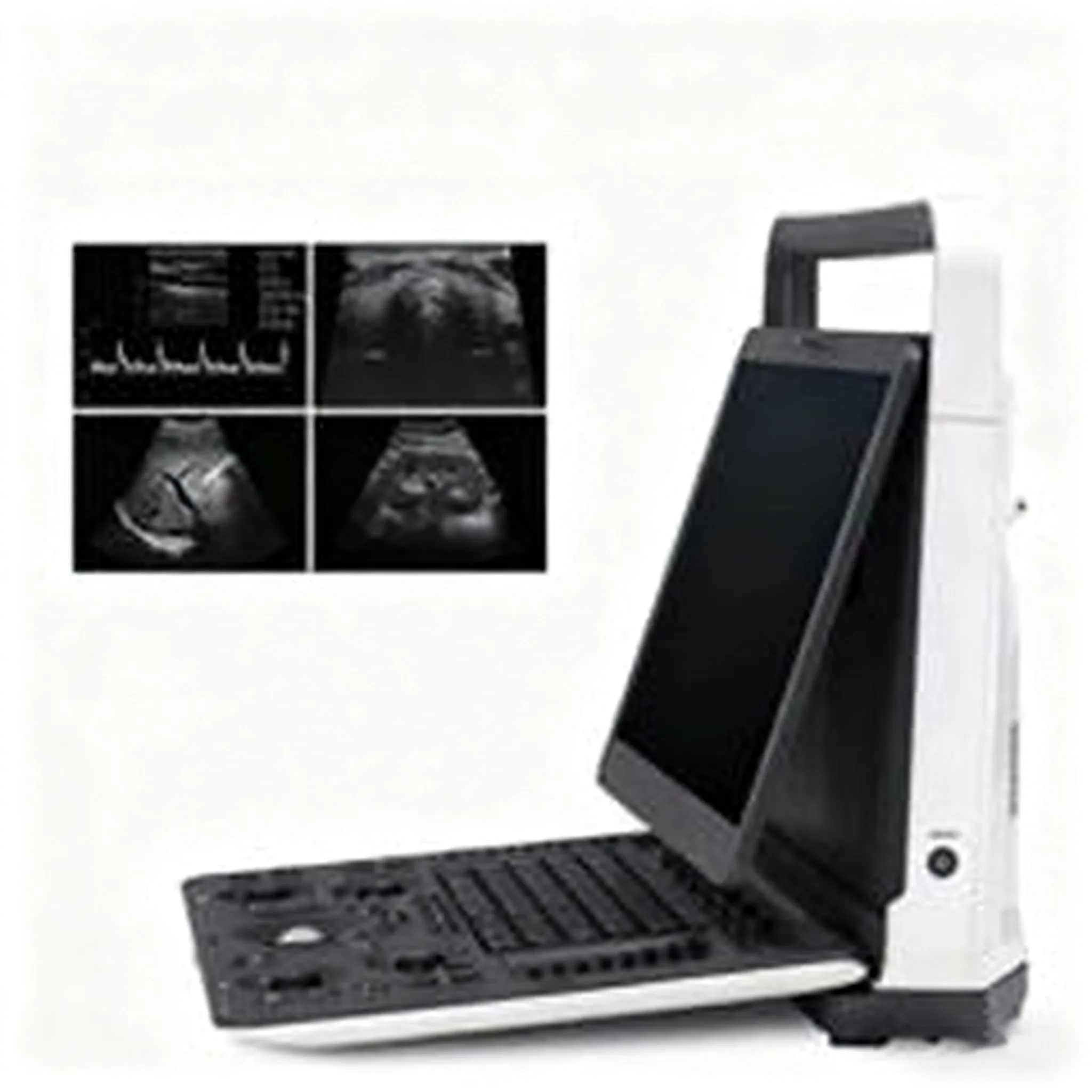 Портативная цветная допплеровская ультразвуковая система Sonoscape E2