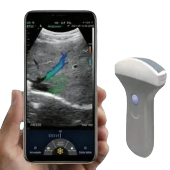 Портативный USB и WiFi цветной допплеровский ультразвуковой сканер AKCSB-C10UR