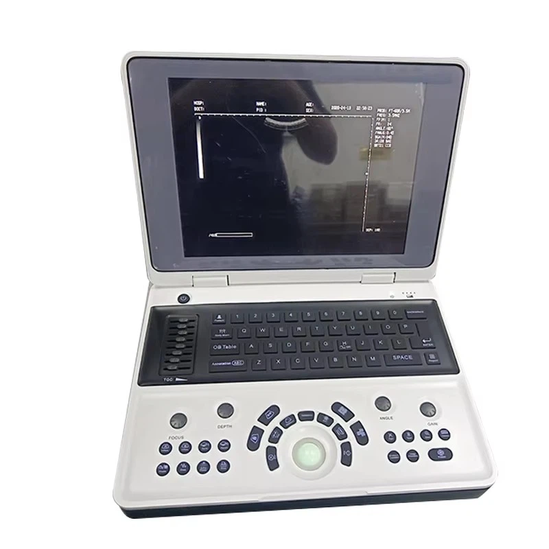 Полностью цифровой ультразвуковой аппарат AKCSB3000W