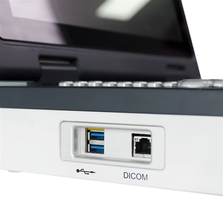 Портативная система цветного допплеровского ультразвукового сканирования Notebook AKCSB-UTS1600