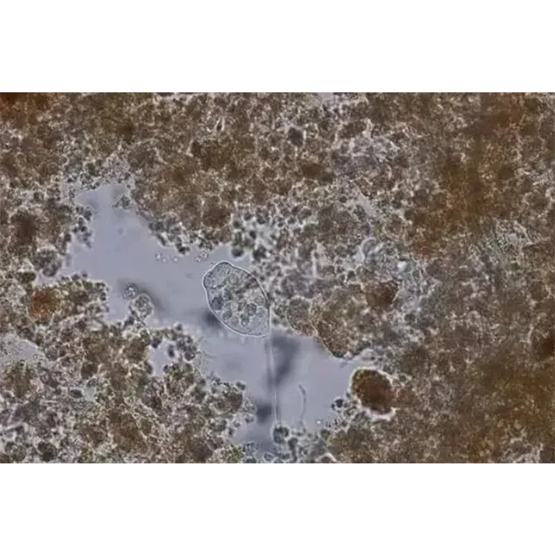 Как повысить эффективность удаления азота и фосфора в условиях низких температур?