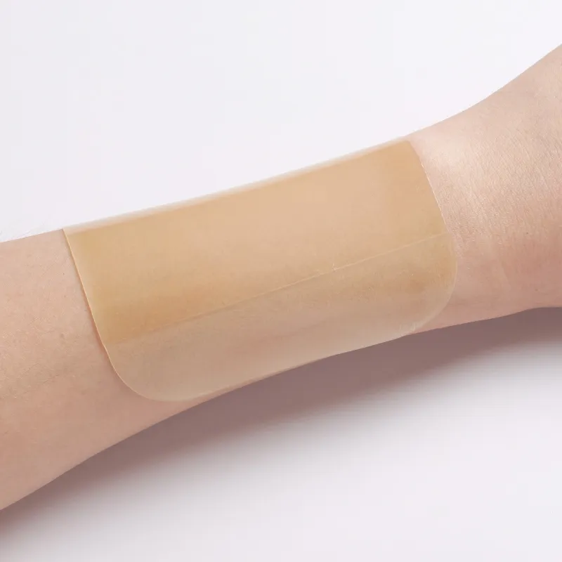 Гидроколлоидная повязка