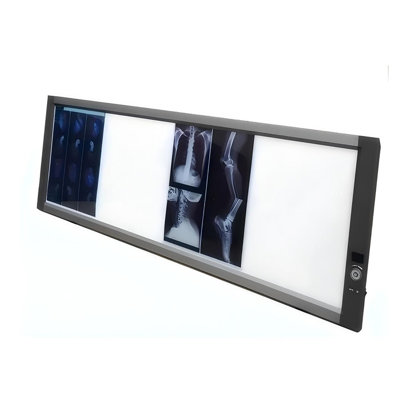 Негатоскоп