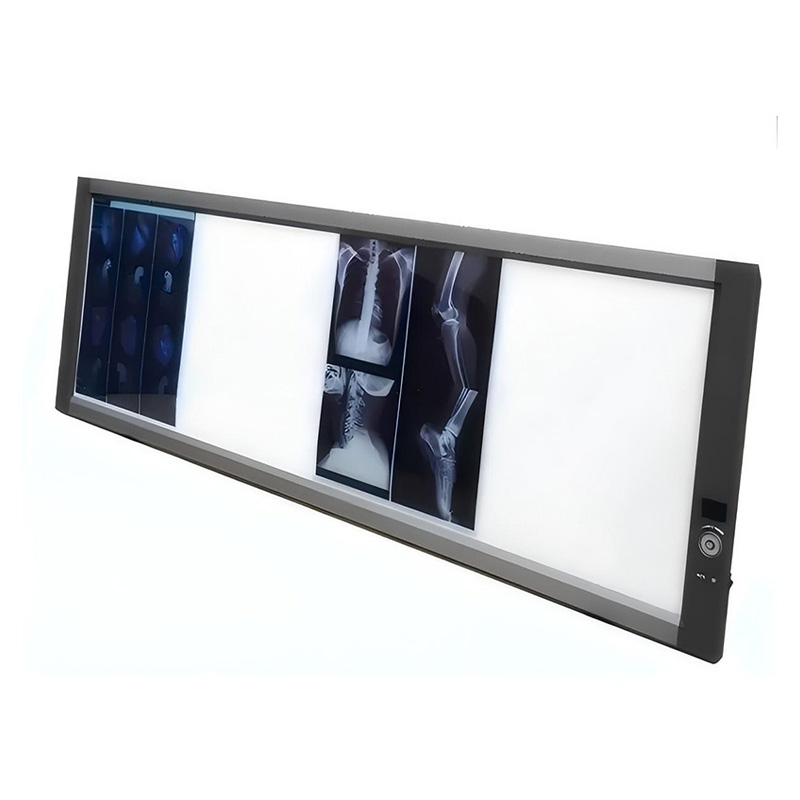 Негатоскоп