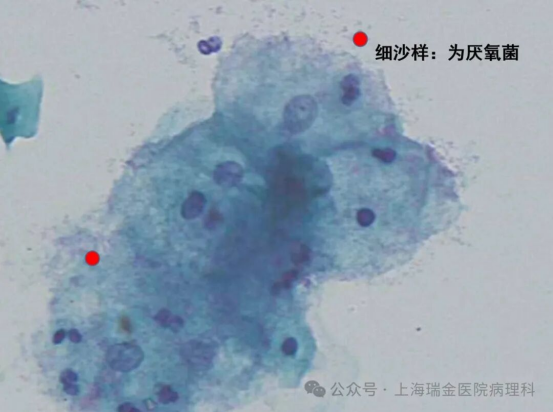 3cb743df01a1cc41c9826abd59b0082b